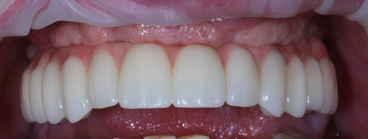 After