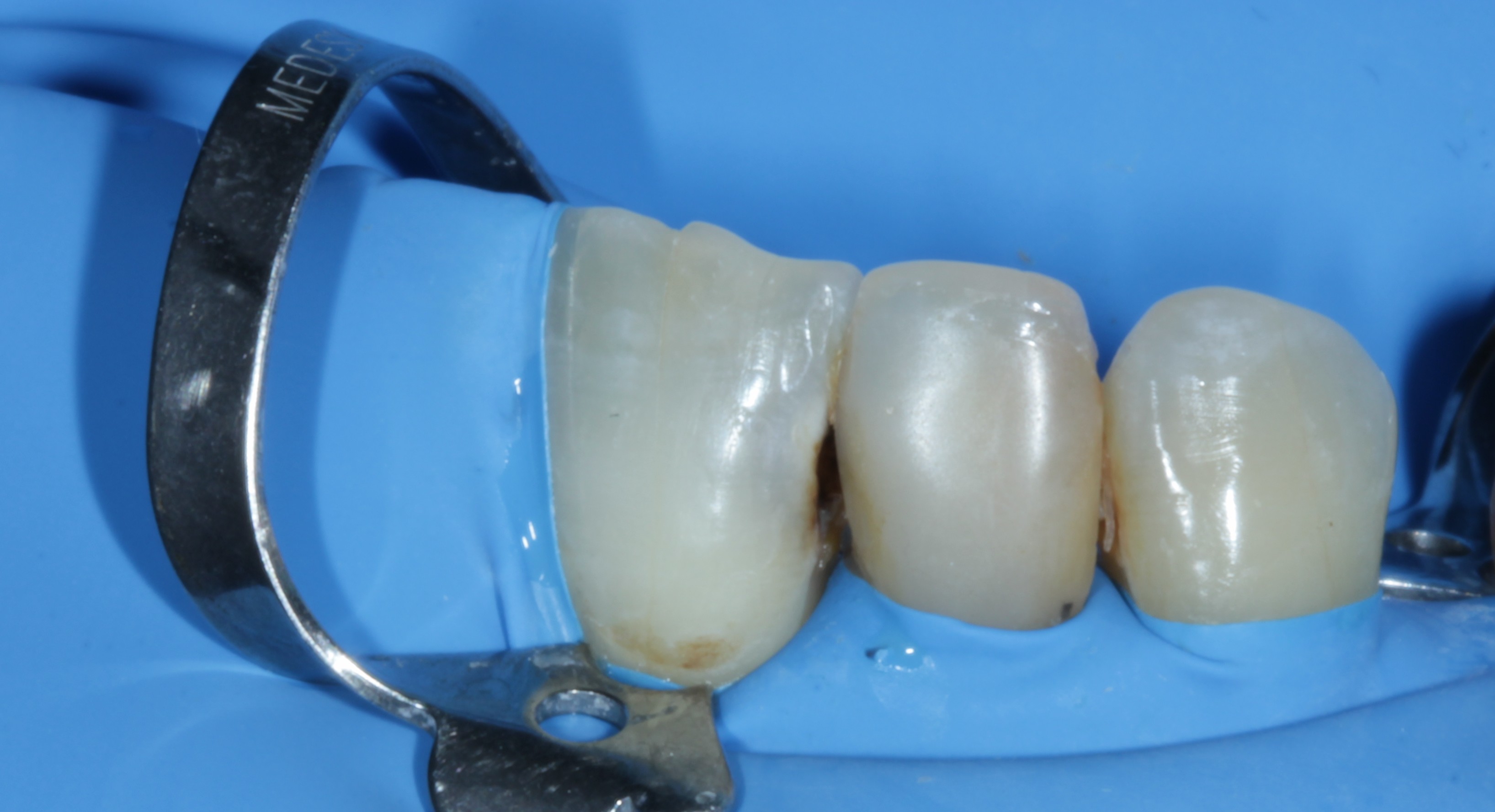 Before