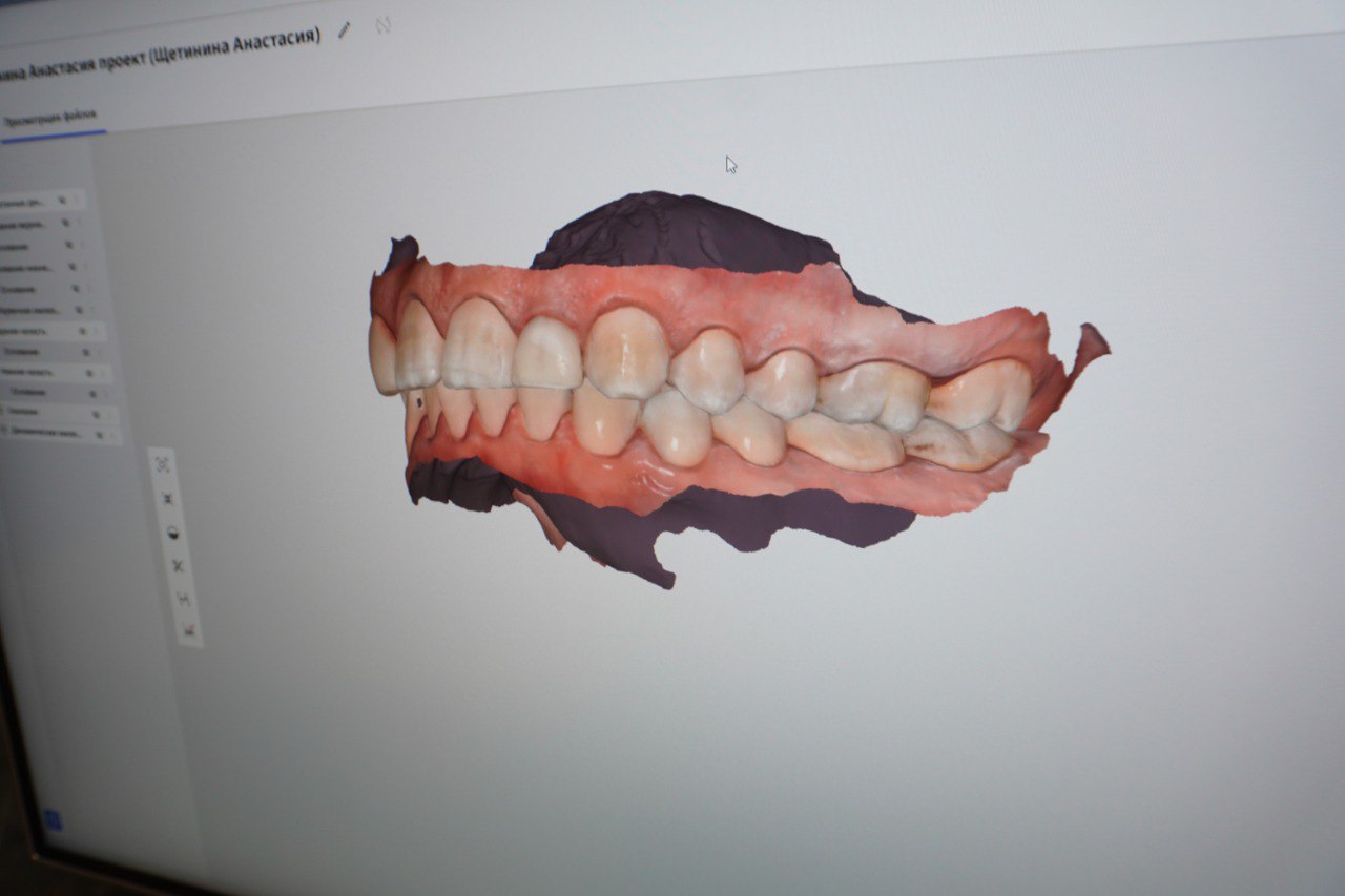 3D сканер
