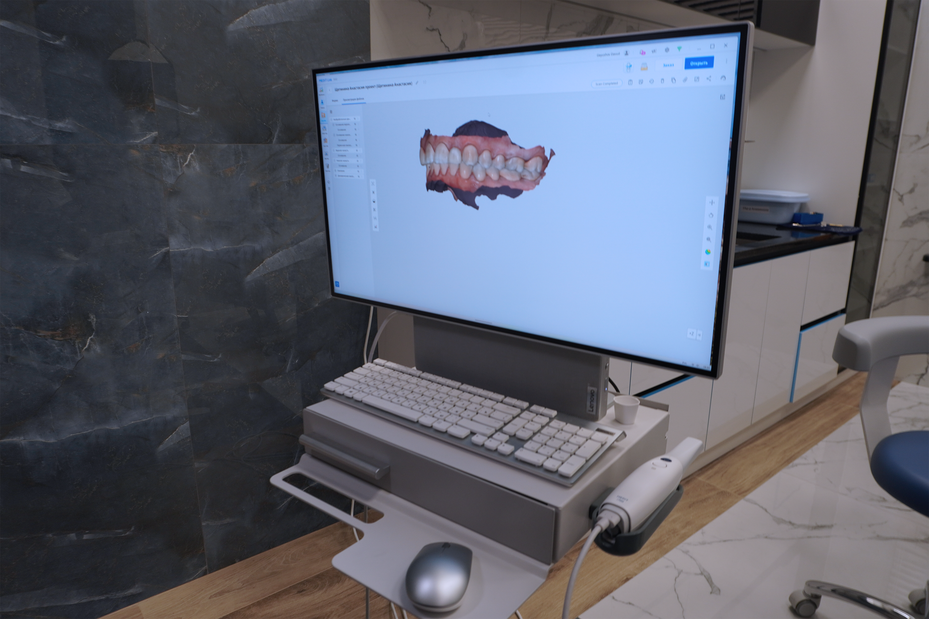 3D-сканер